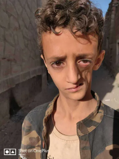 اخبار اليمن الان الحدث اليوم عاجل 