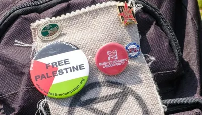 اخبار اليمن الان ارتداء شارات لفلسطين العاملين بمستشفيات اخبار اليمن الان الحدث اليوم عاجل