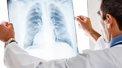 اخبار اليمن الان بصحة سلوكيات تساهم الوقاية السرطان اخبار اليمن الان الحدث اليوم عاجل