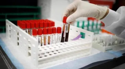 اخبار اليمن الان علماء يكتشفون فصيلة دم جديدة اخبار اليمن الان الحدث اليوم عاجل