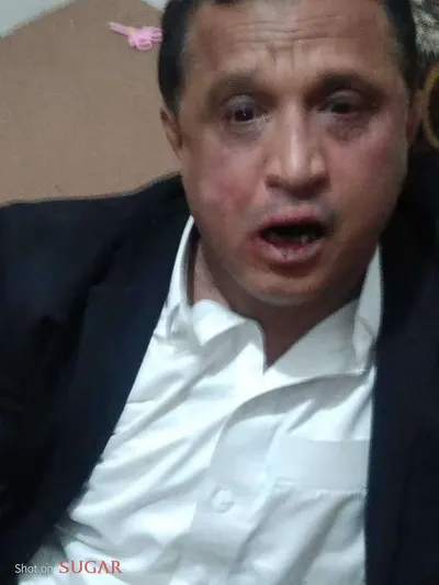 اخبار اليمن الان الحدث اليوم عاجل 