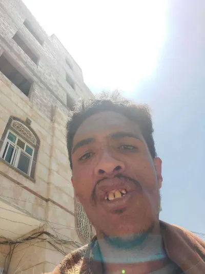 اخبار اليمن الان مفاجأة متوقعة مسروق صاحبه المشتبه اخبار اليمن الان الحدث اليوم عاجل