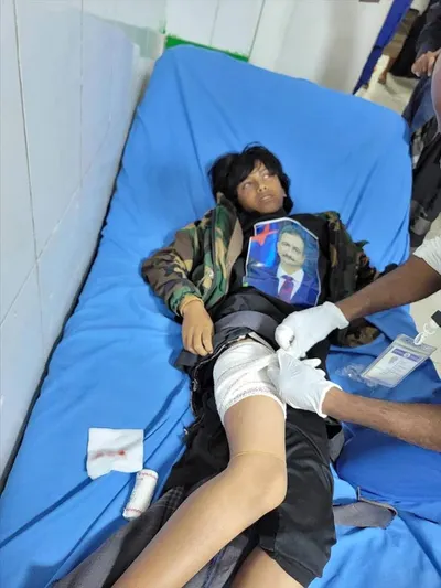 اخبار اليمن الان الحدث اليوم عاجل 