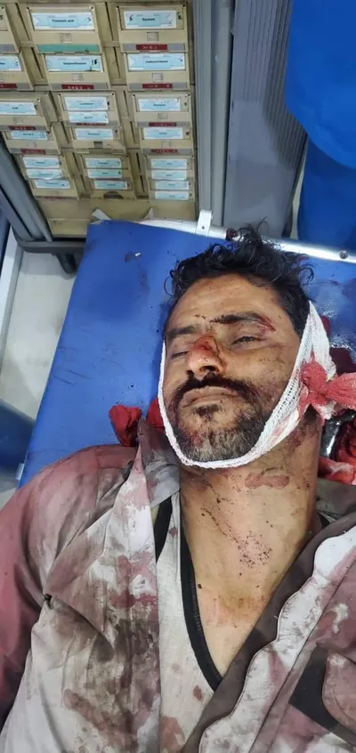 اخبار اليمن الان وفاة سائق شاحنة حادث مروع اخبار اليمن الان الحدث اليوم عاجل