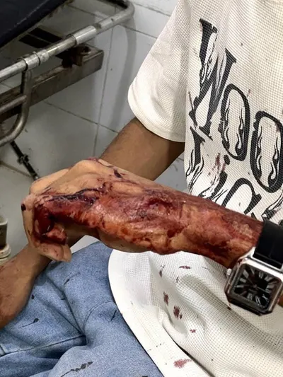 اخبار اليمن الان يتعرض للضرب المبرح والطعن صادمة اخبار اليمن الان الحدث اليوم عاجل