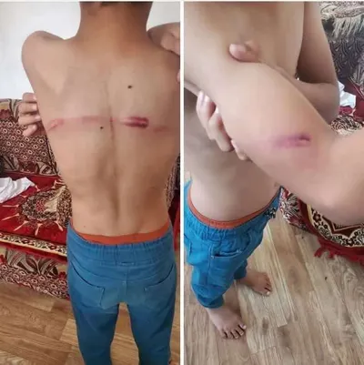 اخبار اليمن الان اعتداء وحشي لتحفيظ القرآن بمأرب اخبار اليمن الان الحدث اليوم عاجل