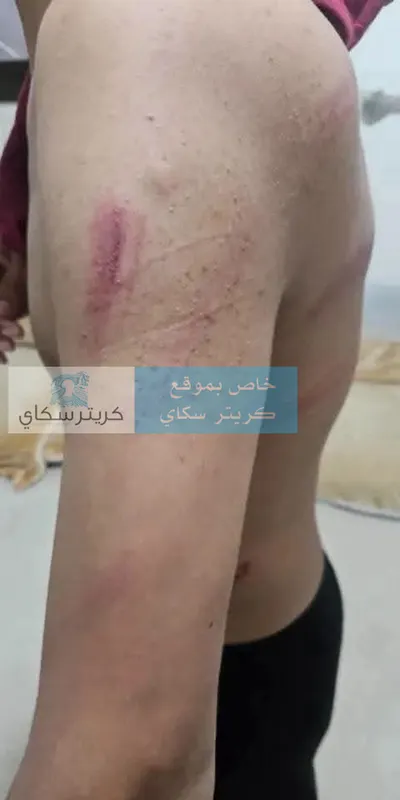اخبار اليمن الان اتهامات صادمة لمدير مدرسة كهربائي اخبار اليمن الان الحدث اليوم عاجل