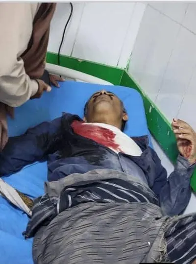 اخبار اليمن الان الحدث اليوم عاجل 