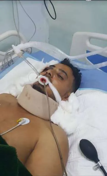 اخبار اليمن الان الحدث اليوم عاجل 