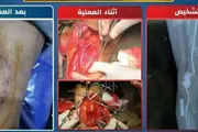 صحيفة الثورة صنعاء اخبار اليمن الان عملية دقيقة مستشفى الثورة بالحديدة اخبار اليمن الان الحدث اليوم عاجل صحيفة الثورة صنعاء