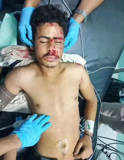 اخبار اليمن الان حادث مروري والمصاب بانتظار التعرف اخبار اليمن الان الحدث اليوم عاجل