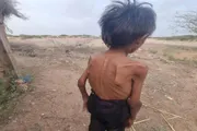 صدى الساحل اخبار اليمن الان مليشيا الحوثي الغذاء اليمنيين للمجاعة اخبار اليمن الان الحدث اليوم عاجل صدى الساحل