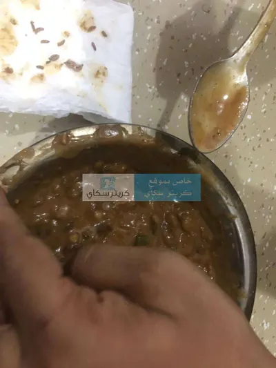 اخبار اليمن الان بالفيديو العثور ديدان بوجبة طعام اخبار اليمن الان الحدث اليوم عاجل