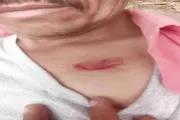عدن تايم اخبار اليمن الان مسعورة تهاجم مواطنين تورصة بالضالع اخبار اليمن الان الحدث اليوم عاجل عدن تايم
