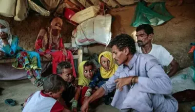 اخبار اليمن الان التغذية بأطفال اليمن العام الجاري اخبار اليمن الان الحدث اليوم عاجل