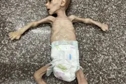 وكالة الصحافة اليمنية اخبار اليمن الان طفلين فلسطينيين وجنوب التغذية والمجاعة اخبار اليمن الان الحدث اليوم عاجل وكالة الصحافة اليمنية