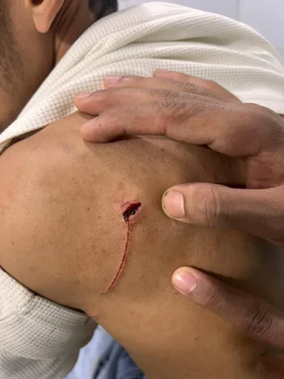 اخبار اليمن الان يتعرض للضرب المبرح والطعن صادمة اخبار اليمن الان الحدث اليوم عاجل