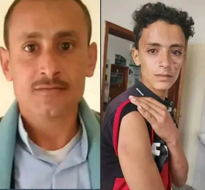 اخبار اليمن الان الحدث اليوم عاجل 