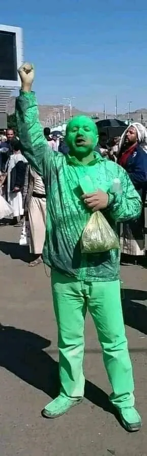 اخبار اليمن الان فقدان المهمشين كيمائية الدهان الأخضر اخبار اليمن الان الحدث اليوم عاجل