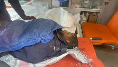 اخبار اليمن الان شهداء إصابات صهيوني الديك القطاع اخبار اليمن الان الحدث اليوم عاجل