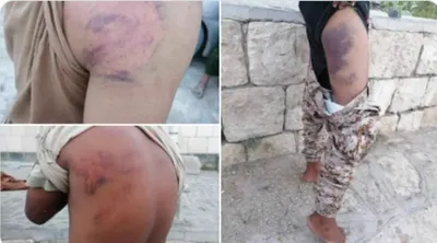 اخبار اليمن الان الحدث اليوم عاجل 