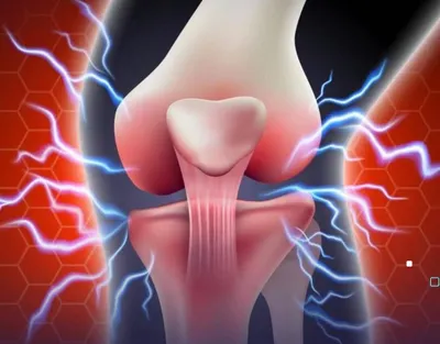 اخبار اليمن الان تحذير العادات الشائعة هشاشة العظام اخبار اليمن الان الحدث اليوم عاجل