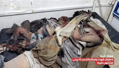 اخبار اليمن الان أطفال وامرأة إصاباتهم العدوان الأمريكي اخبار اليمن الان الحدث اليوم عاجل