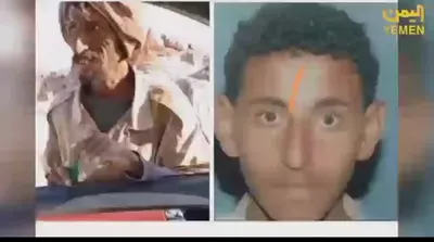 اخبار اليمن الان الحدث اليوم عاجل 