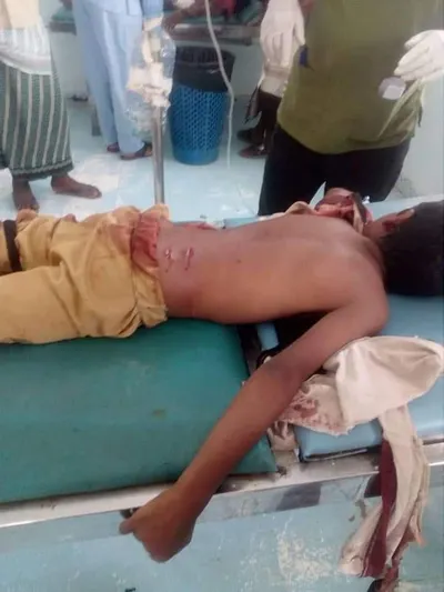 اخبار اليمن الان الحدث اليوم عاجل 