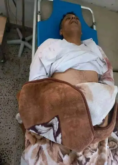 اخبار اليمن الان الحدث اليوم عاجل 