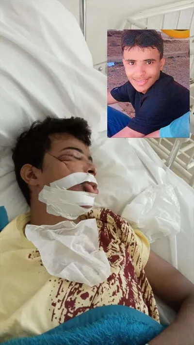 اخبار اليمن الان عسكري تابع لقوات العمالقة شوارع اخبار اليمن الان الحدث اليوم عاجل