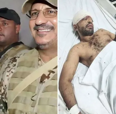 اخبار اليمن الان الحدث اليوم عاجل 