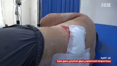 اخبار اليمن الان ومشاهد الجريمة السعودية المدنيين بمحافظة اخبار اليمن الان الحدث اليوم عاجل
