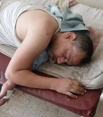 اخبار اليمن الان يتعرض لحادث مأساوي والكشف هويته اخبار اليمن الان الحدث اليوم عاجل