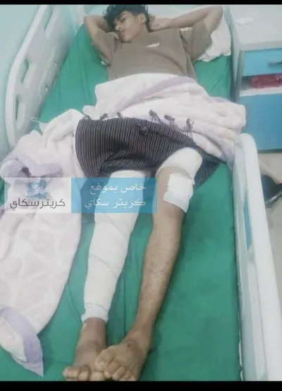 اخبار اليمن الان صدور قهري واعتقال جريح المستشفى اخبار اليمن الان الحدث اليوم عاجل