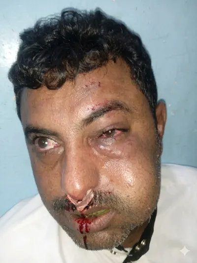 اخبار اليمن الان الاعتداء محامي شارع بمحافظة الحديدة اخبار اليمن الان الحدث اليوم عاجل