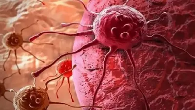 اخبار اليمن الان استشارية جراحة أورام تحذر أخطار اخبار اليمن الان الحدث اليوم عاجل