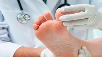 اخبار اليمن الان سعودية فعالية الاصطناعي مضاعفات السكرية  اخبار اليمن الان الحدث اليوم عاجل