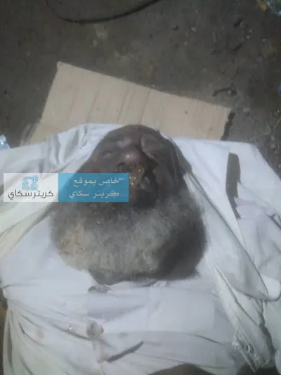 اخبار اليمن الان العثور مجهولة الهوية شوارع المنصورة اخبار اليمن الان الحدث اليوم عاجل