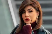 صحيفة المرصد اخبار اليمن الان مجنونة عمليات التجميل مضاعفاتها والمالية اخبار اليمن الان الحدث اليوم عاجل صحيفة المرصد