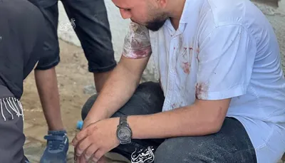اخبار اليمن الان مجزرة مروعة جباليا الصحفي الرحيم اخبار اليمن الان الحدث اليوم عاجل