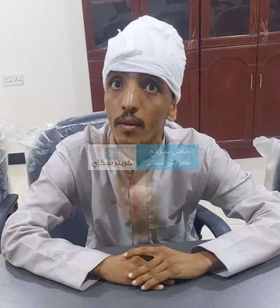 اخبار اليمن الان الكشف هوية الشخص للاعتداء العروض اخبار اليمن الان الحدث اليوم عاجل