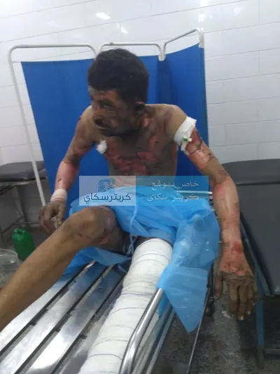 اخبار اليمن الان للتاجر الشمالي مامور الشيخ عثمان اخبار اليمن الان الحدث اليوم عاجل