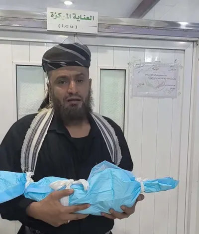 اخبار اليمن الان وفاة طفلة رضيعة ولادتها  اخبار اليمن الان الحدث اليوم عاجل