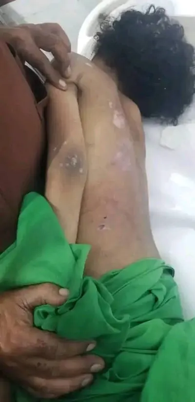 اخبار اليمن الان الحدث اليوم عاجل 