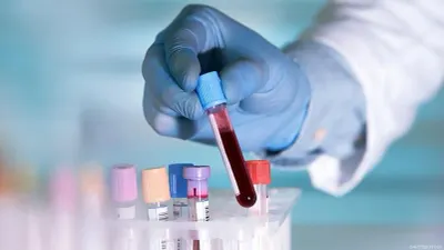 اخبار اليمن الان الصحة العامة الزواج ومستقبل أبنائك اخبار اليمن الان الحدث اليوم عاجل