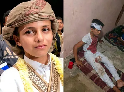 اخبار اليمن الان الحدث اليوم عاجل 