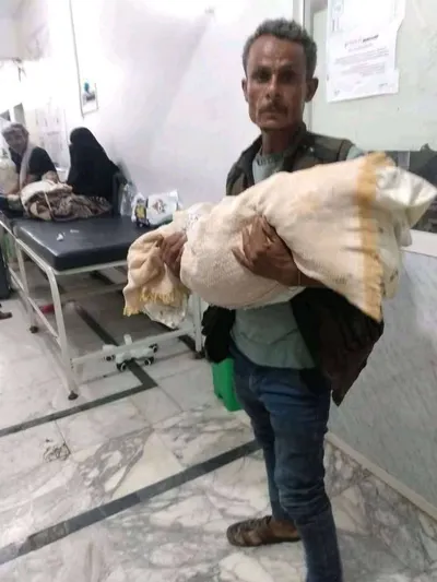 اخبار اليمن الان الحدث اليوم عاجل 