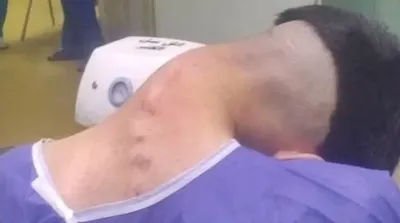 اخبار اليمن الان انحناء قاتل المخدرات وحولته مرعبة اخبار اليمن الان الحدث اليوم عاجل