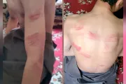 اخبار اليمن الان الحدث اليوم عاجل وكالة 2 ديسمبر